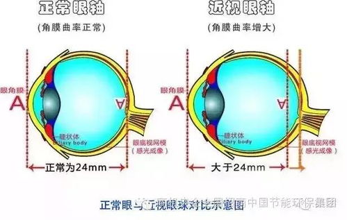成效卓著的日本 本部式视力复活操 ,竟使自己原本不到0.3的视力,回复到1.0