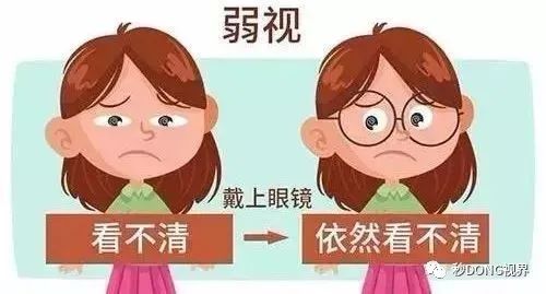弱视 你所想不到的“懒惰”，不只是近视弱